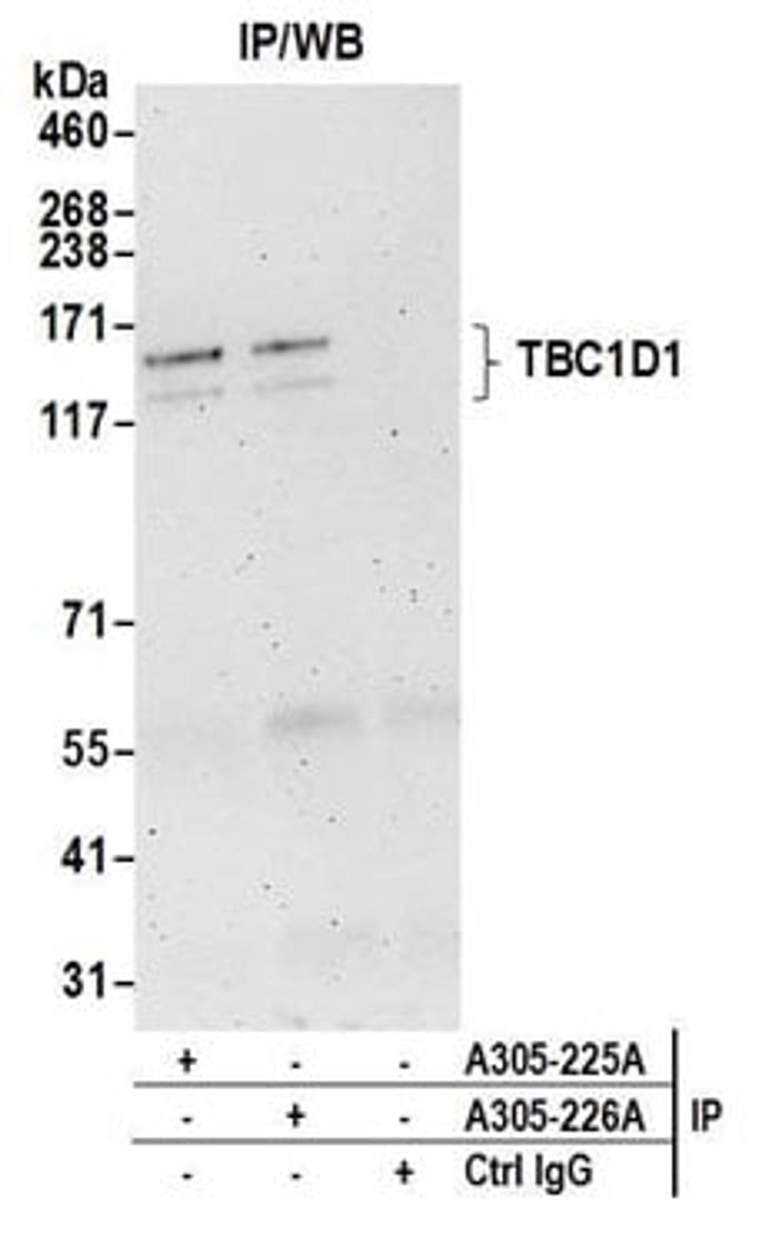 Detection of human TBC1D1 by western blot of immunoprecipitates.