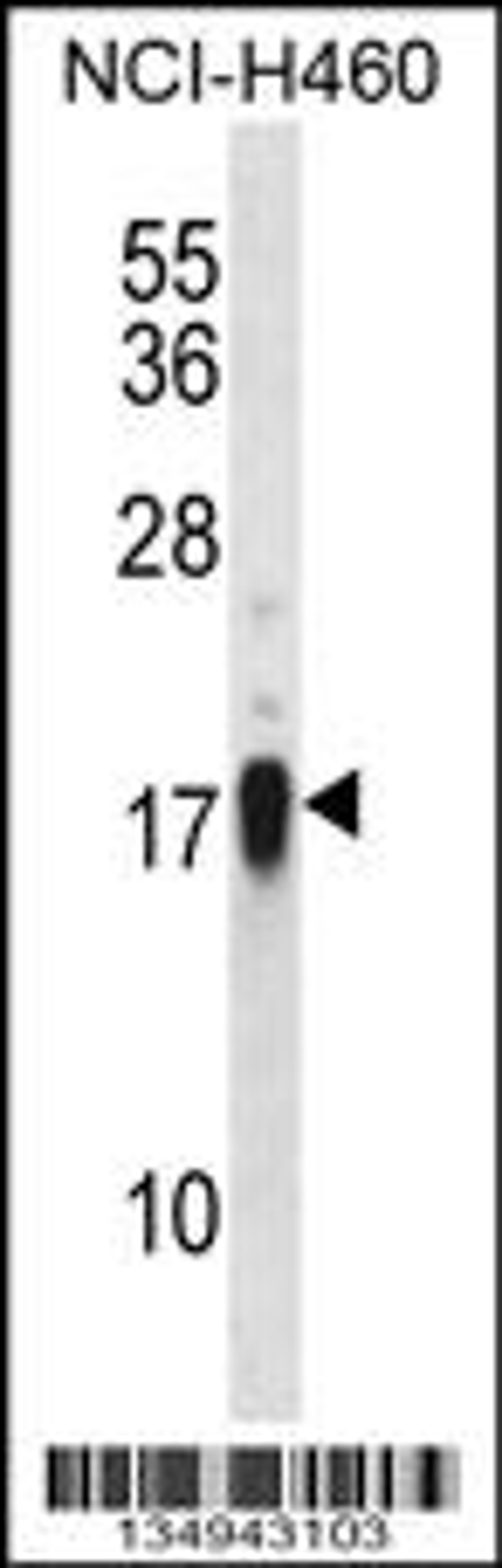 Western blot analysis in NCI-H460 cell line lysates (35ug/lane).