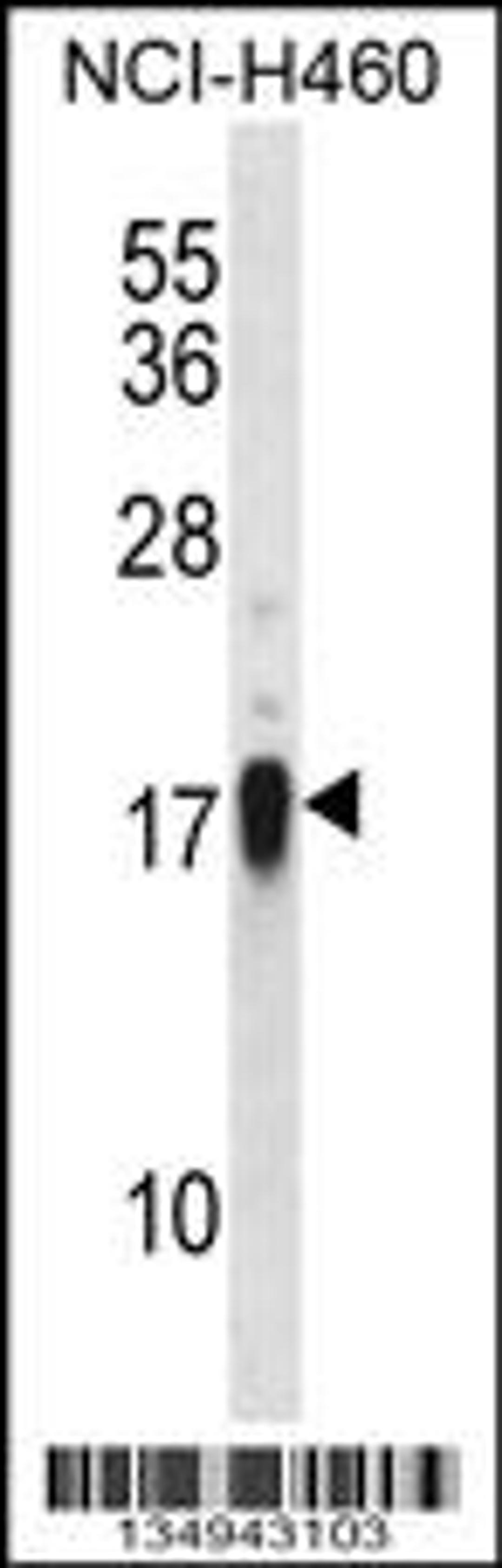 Western blot analysis in NCI-H460 cell line lysates (35ug/lane).