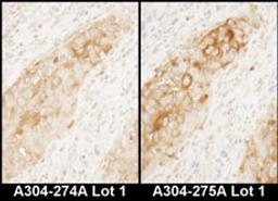 Detection of human WARS by immunohistochemistry.