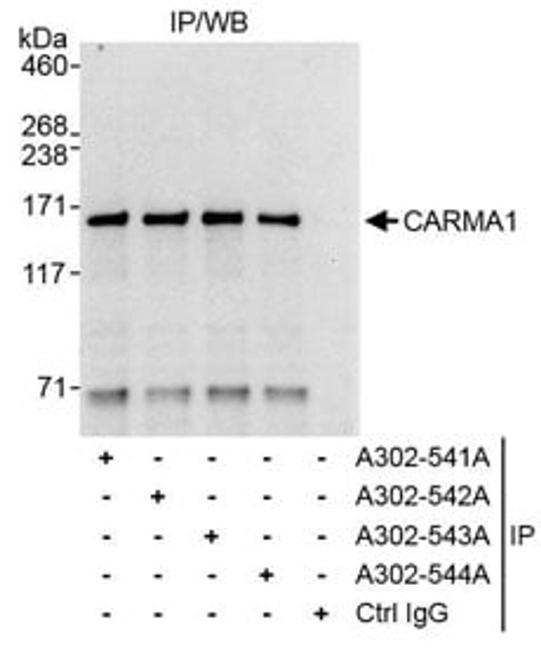 Detection of human CARMA1 by western blot of immunoprecipitates.