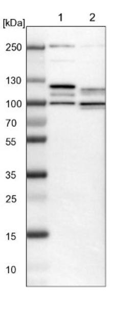 Western Blot: PRKRIR Antibody [NBP1-85312] - Lane 1: NIH-3T3 cell lysate (Mouse embryonic fibroblast cells)<br/>Lane 2: NBT-II cell lysate (Rat Wistar bladder tumour cells)