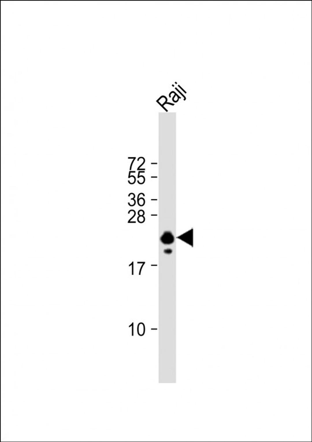 Western Blot at 1:1000 dilution + Raji whole cell lysate Lysates/proteins at 20 ug per lane.