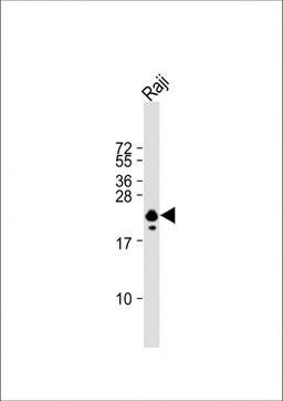 Western Blot at 1:1000 dilution + Raji whole cell lysate Lysates/proteins at 20 ug per lane.