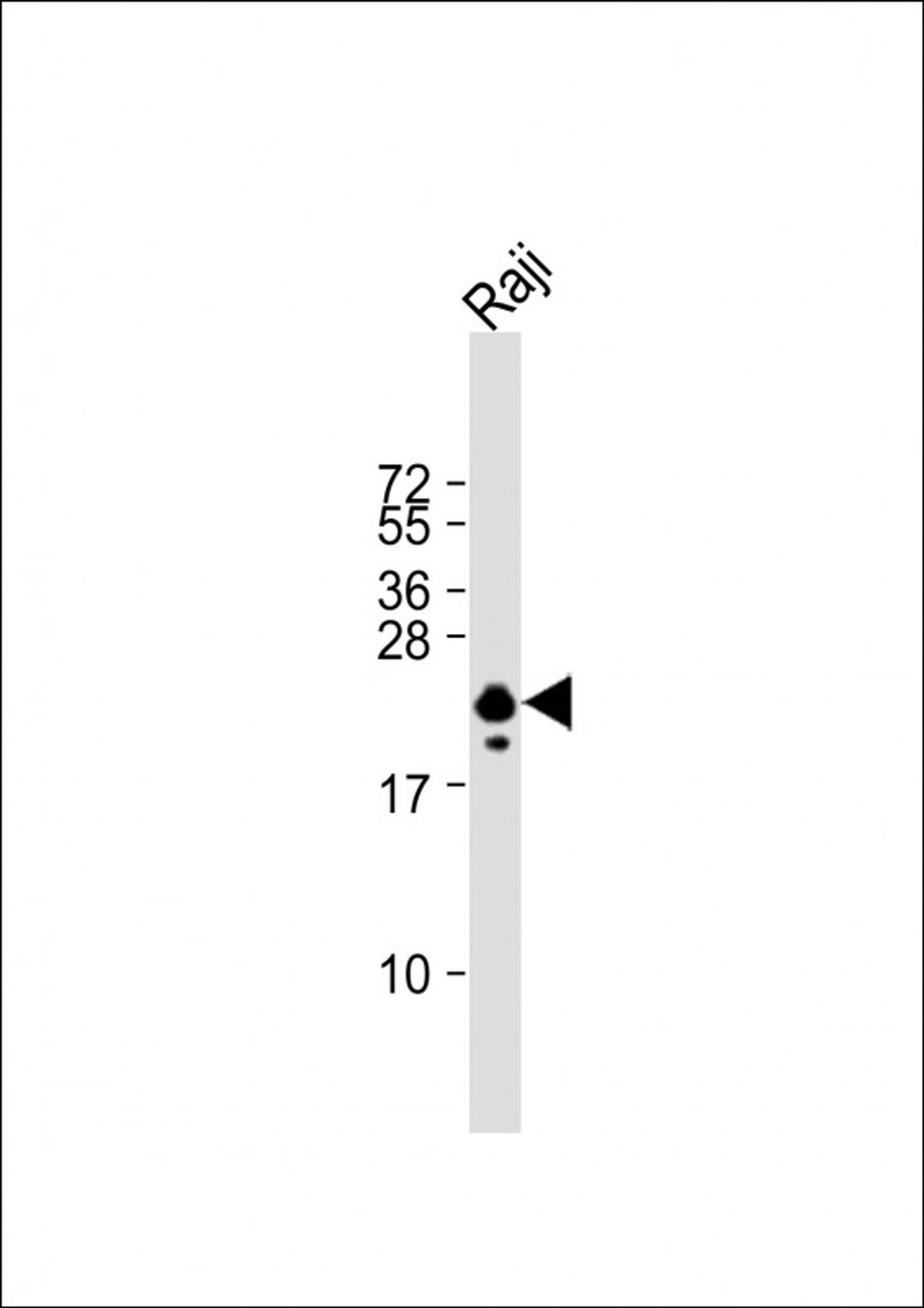 Western Blot at 1:1000 dilution + Raji whole cell lysate Lysates/proteins at 20 ug per lane.