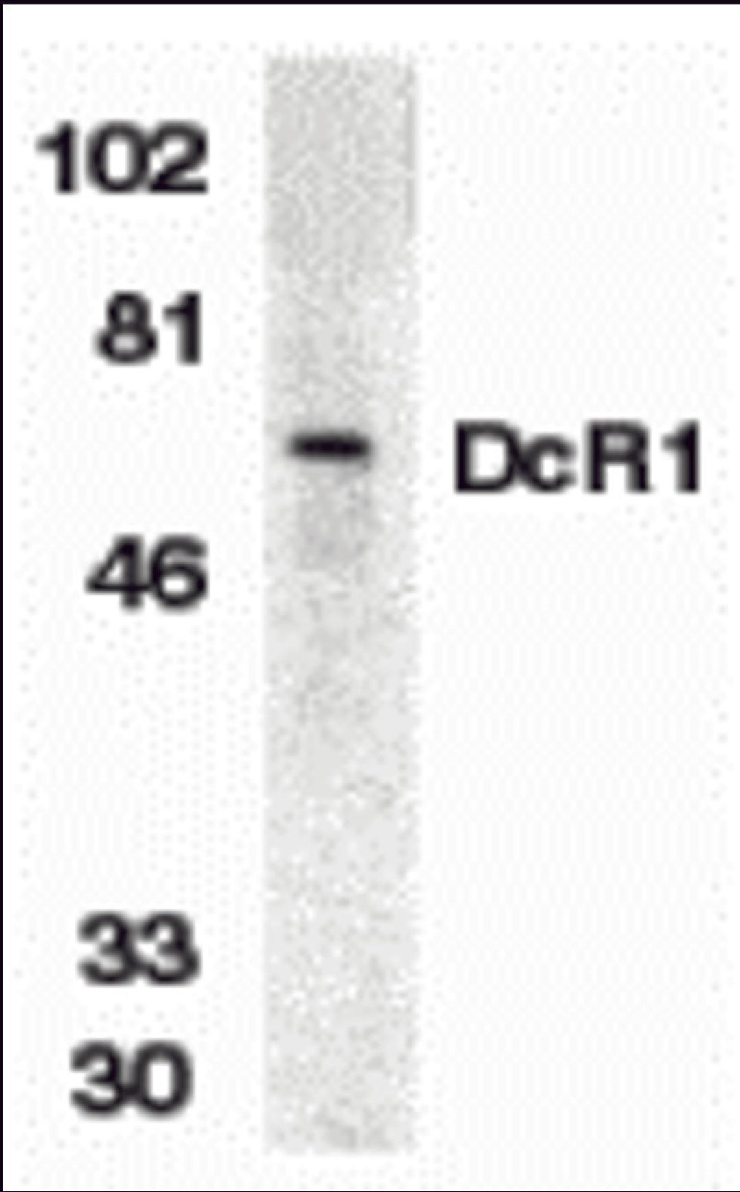 Western blot analysis of DcR1 in HeLa whole cell lysate with DcR1 antibody (ED) at 1:500 dilution. 