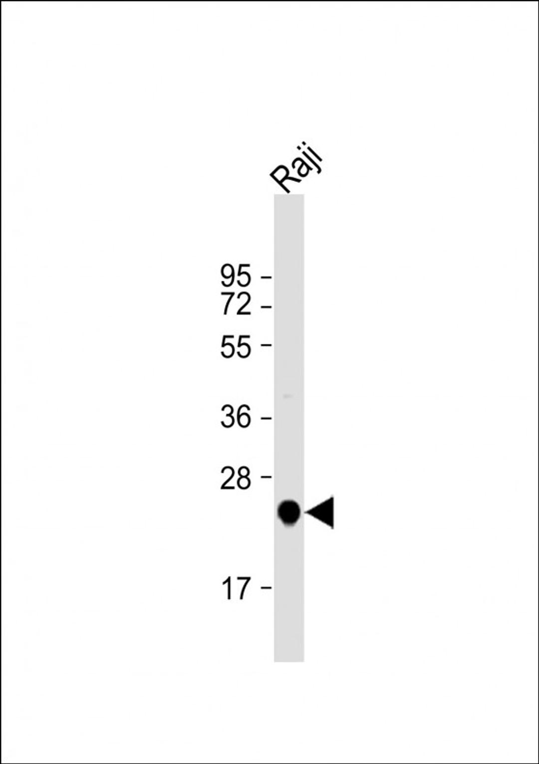 Western Blot at 1:1000 dilution + Raji whole cell lysate Lysates/proteins at 20 ug per lane.