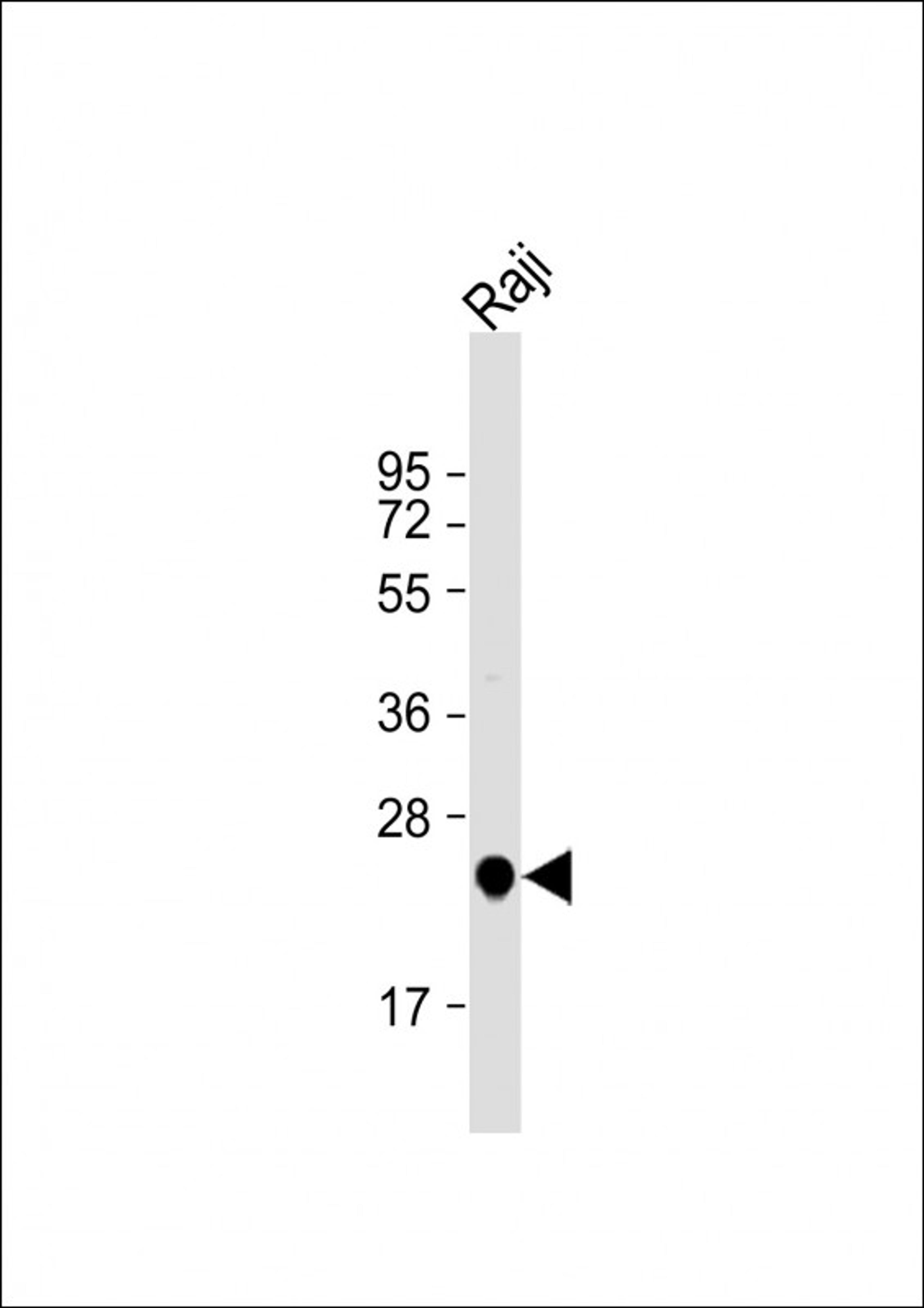 Western Blot at 1:1000 dilution + Raji whole cell lysate Lysates/proteins at 20 ug per lane.