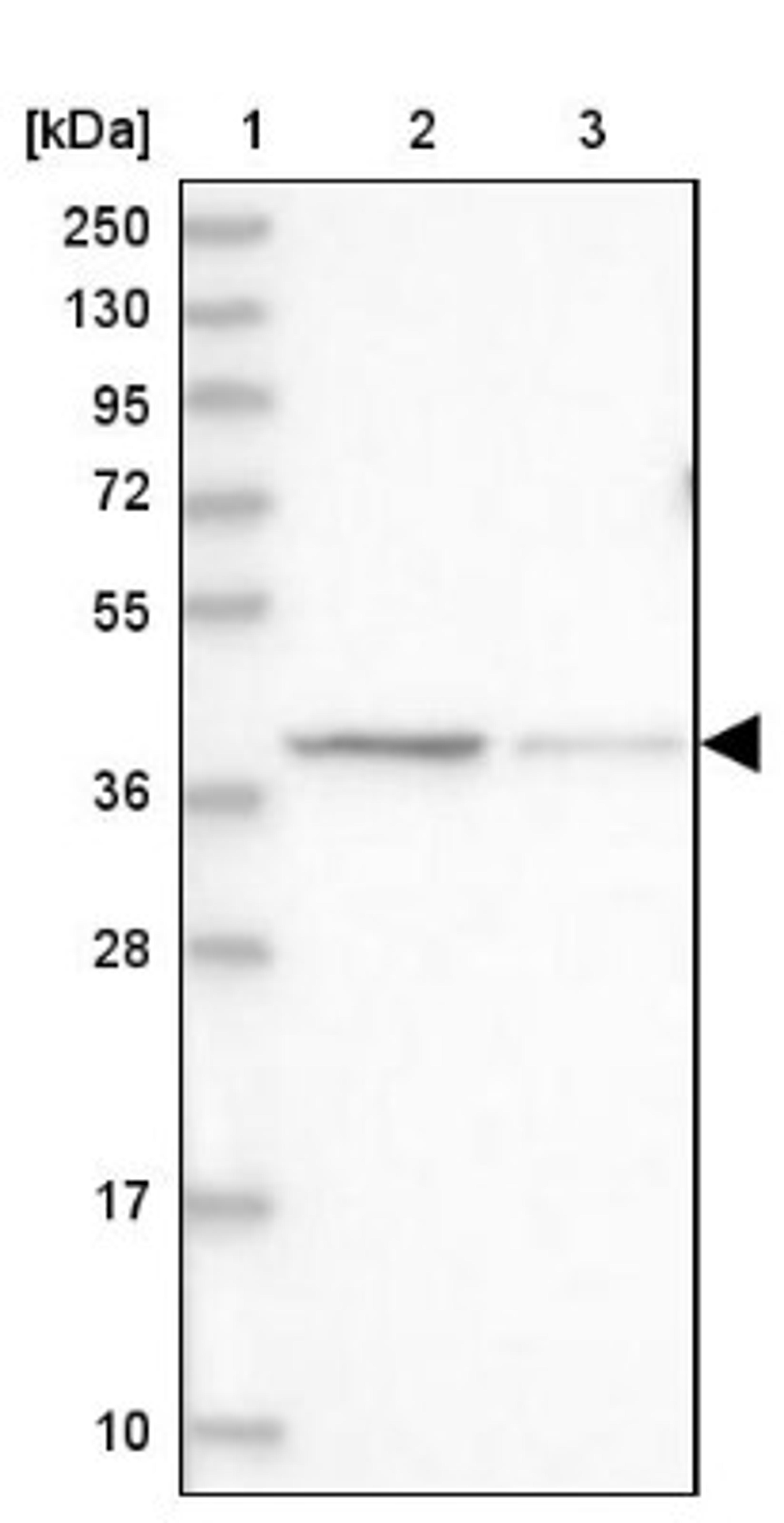 Western Blot: LRRC31 Antibody [NBP1-93932] - Lane 1: Marker [kDa] 250, 130, 95, 72, 55, 36, 28, 17, 10<br/>Lane 2: Human cell line RT-4<br/>Lane 3: Human cell line U-251MG sp