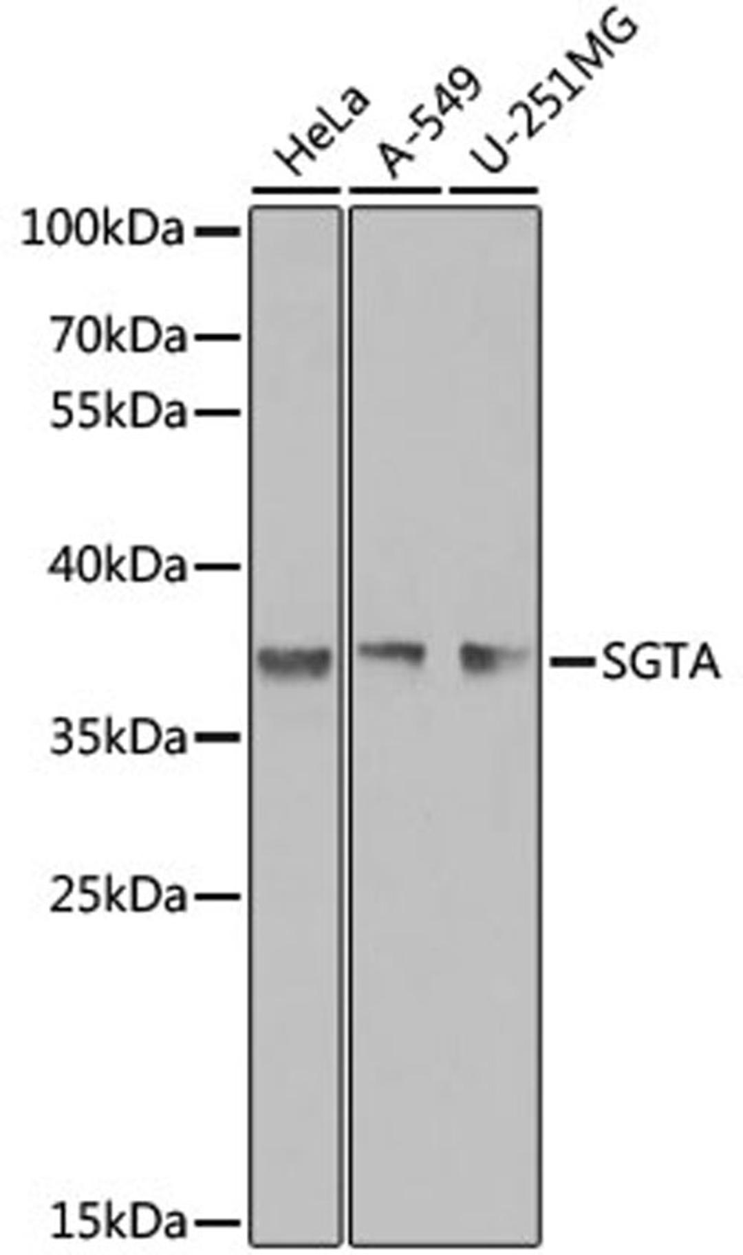 Western blot - SGTA antibody (A7306)