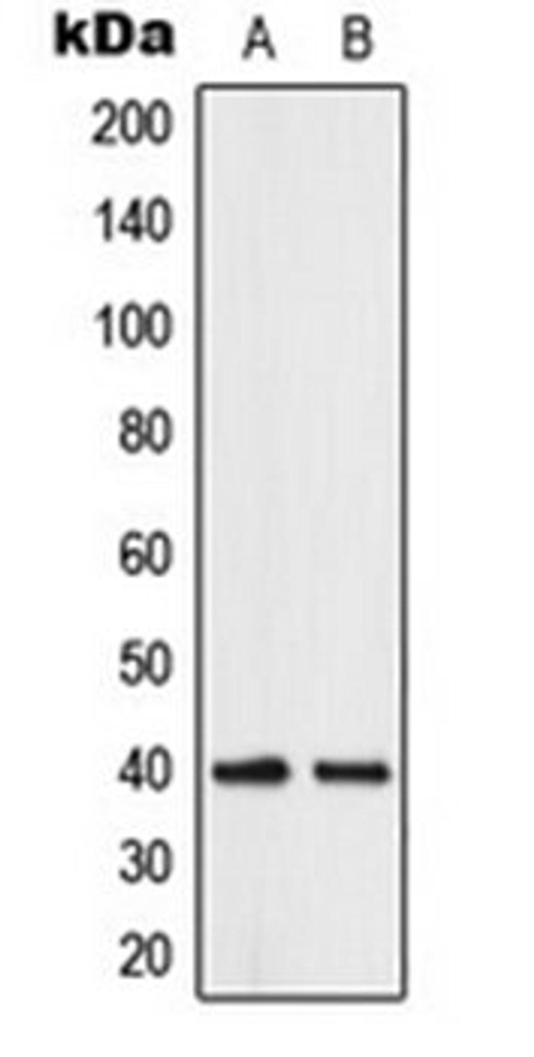 Western blot analysis of human brain (Lane 1), K562 (Lane 2) whole cell lysates using ABHD12B antibody