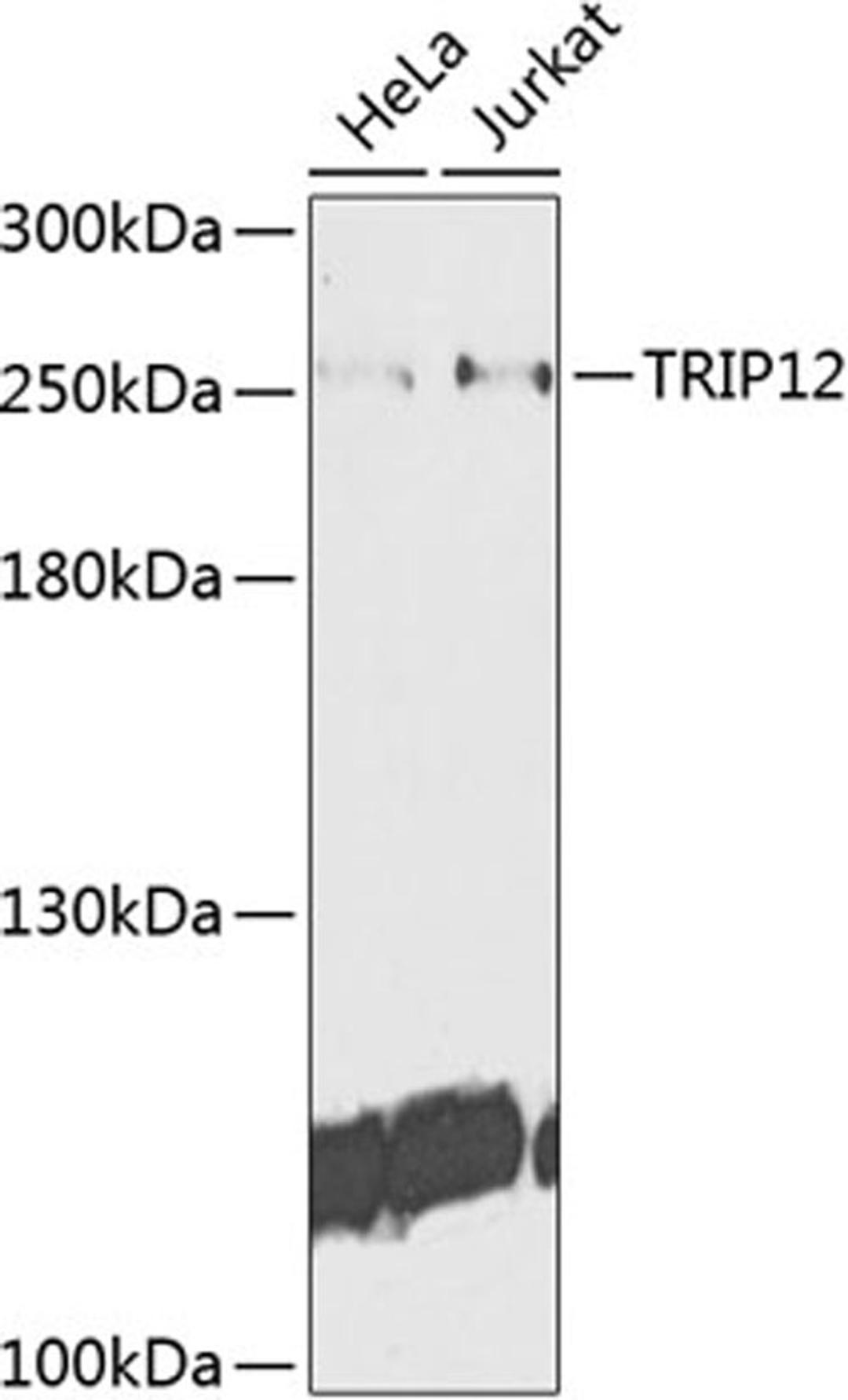 Western blot - TRIP12 antibody (A9958)