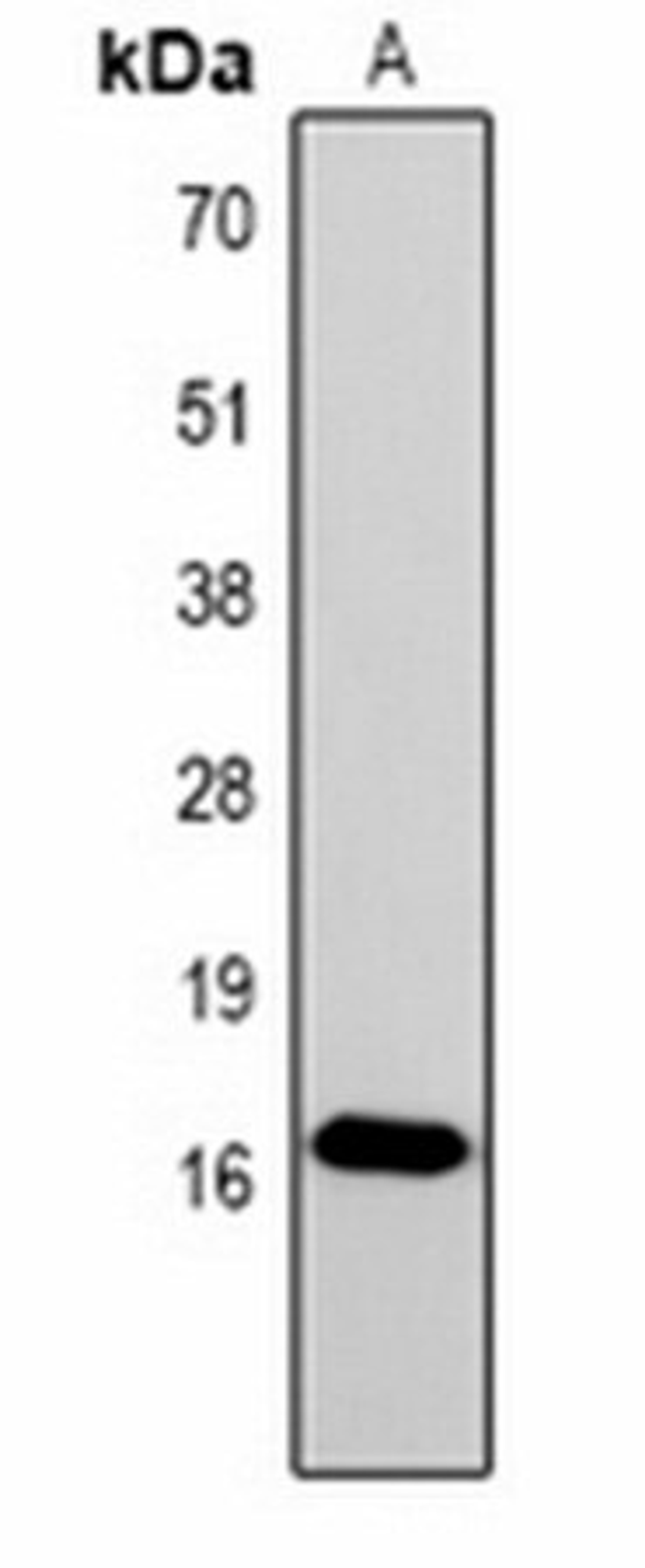 Western blot analysis of  Hela (Lane1) whole cell lysates using Histone H1 (Phospho-S2) antibody