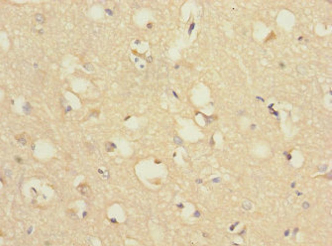 Immunohistochemistry of paraffin-embedded human brain tissue using CSB-PA887022ESR2HU at dilution of 1:100