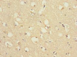 Immunohistochemistry of paraffin-embedded human brain tissue using CSB-PA887022ESR2HU at dilution of 1:100