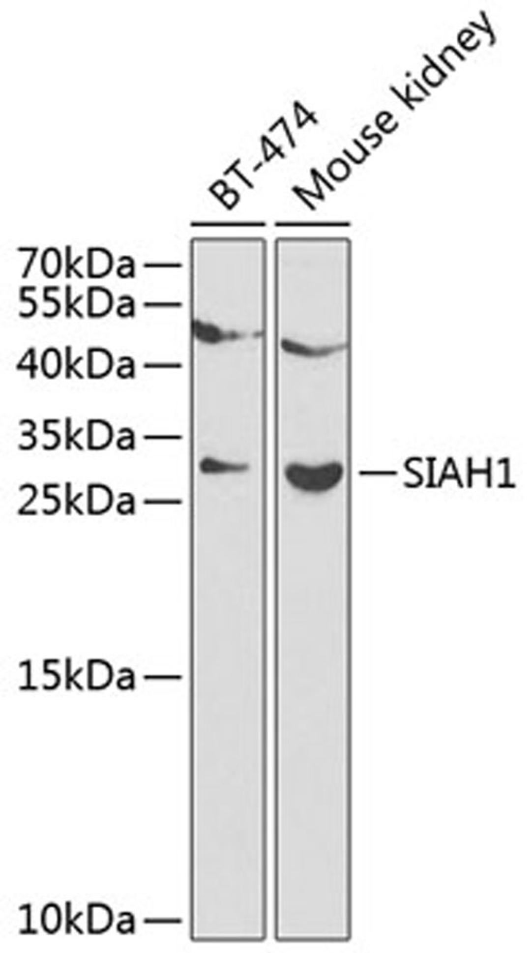 Western blot - SIAH1 antibody (A12490)