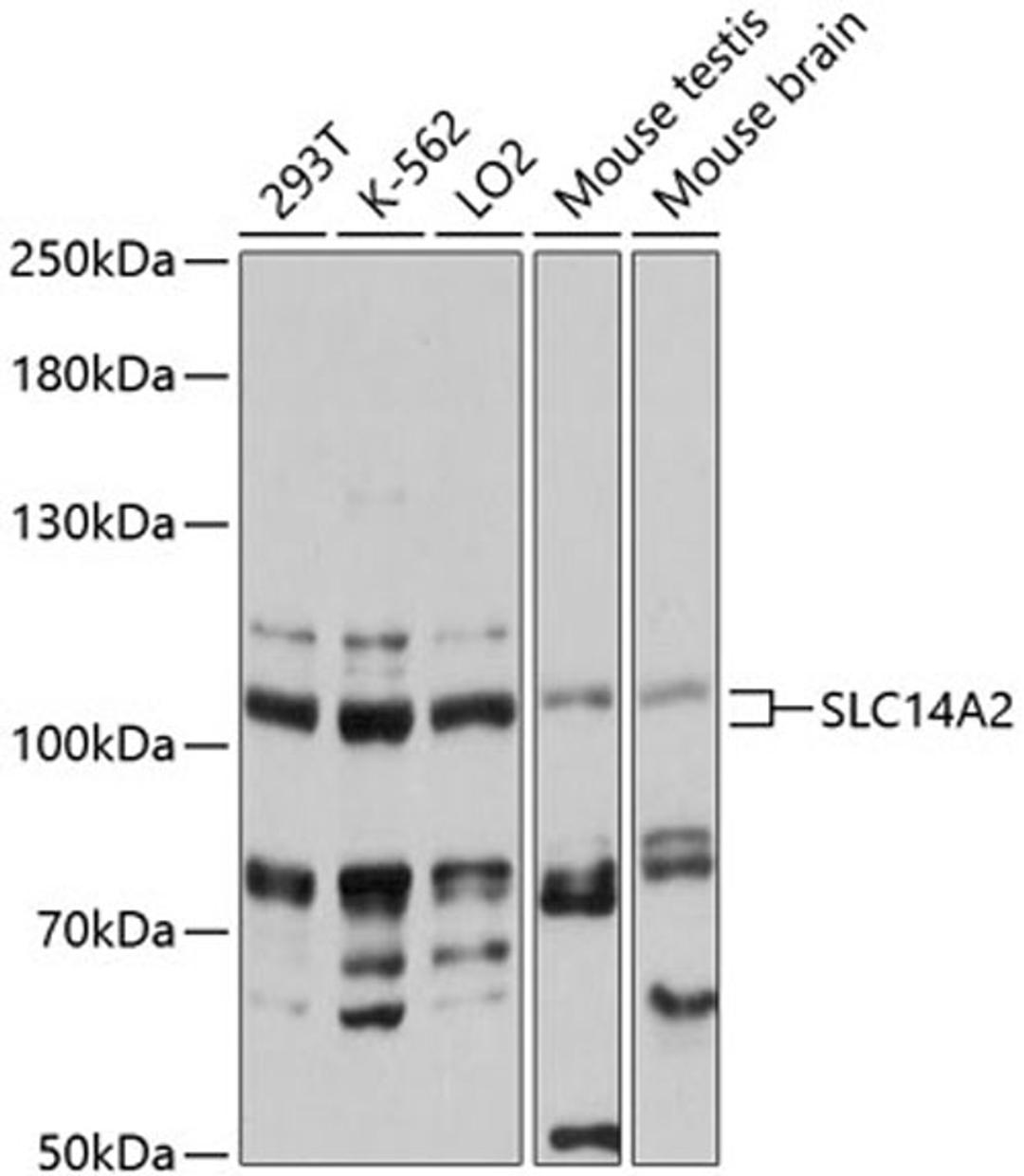 Western blot - SLC14A2 antibody (A13208)