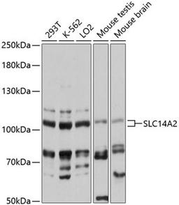 Western blot - SLC14A2 antibody (A13208)