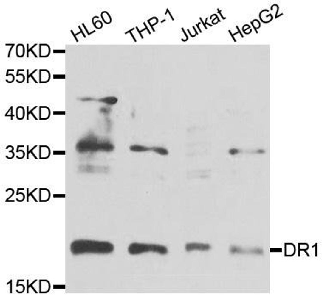 Western blot analysis of extracts of various cell lines using DR1 antibody