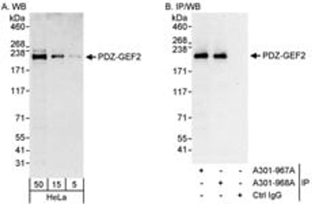 Detection of human PDZ-GEF2 by western blot and immunoprecipitation.