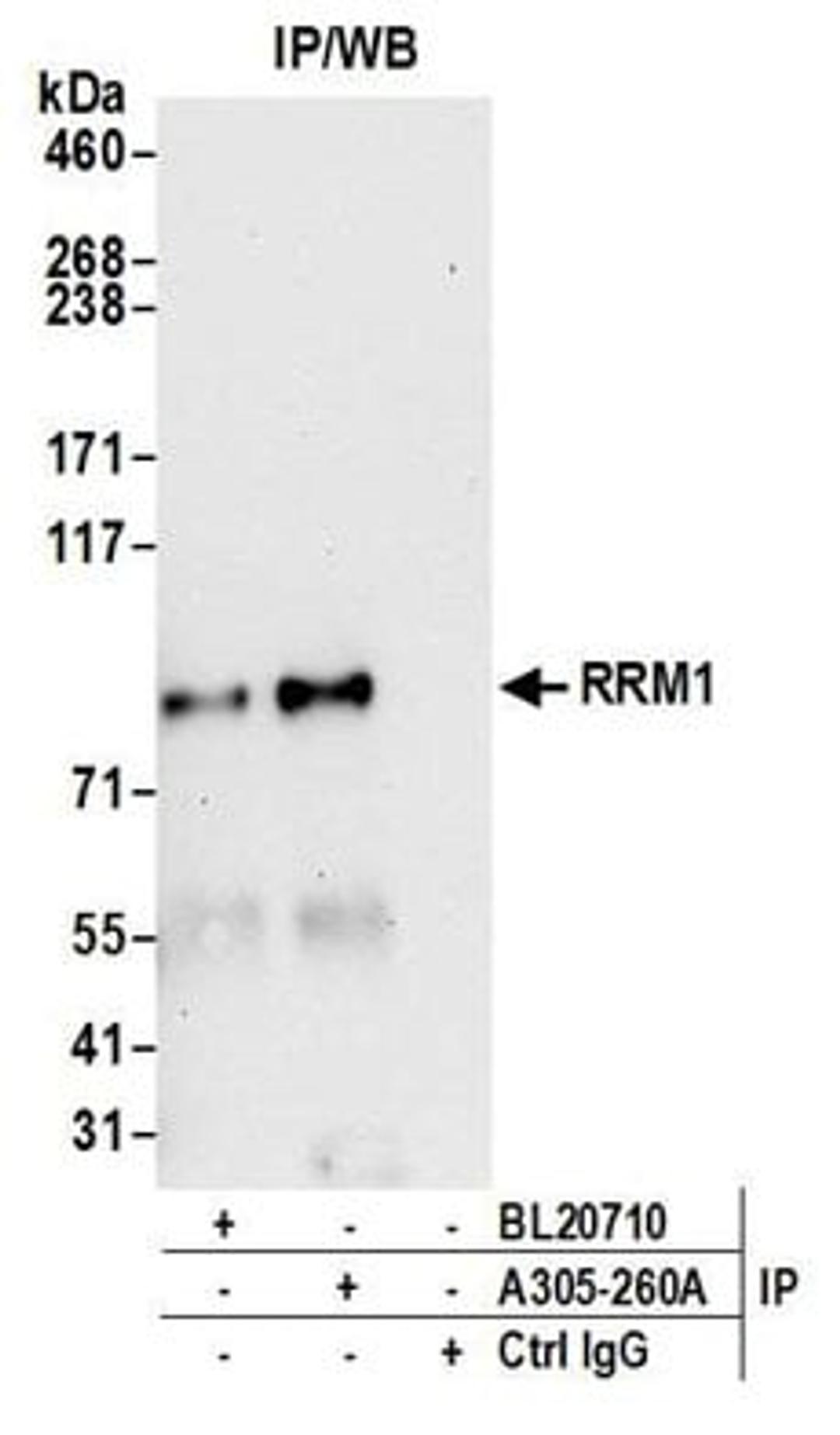 Detection of human RRM1 by western blot of immunoprecipitates.