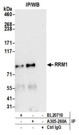 Detection of human RRM1 by western blot of immunoprecipitates.