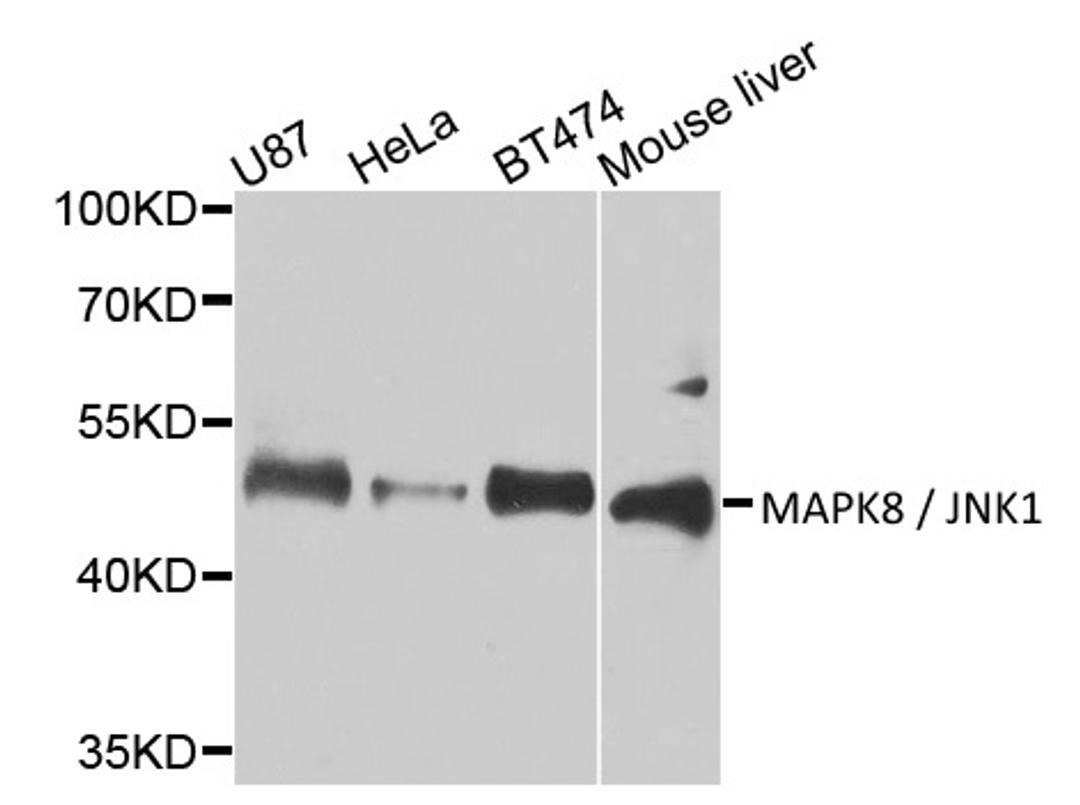 Western blot analysis of cell and mouse liver tissue lysates using Rabbit anti MAPK8/JNK1 antibody