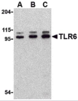 Western blot analysis of TLR6 in Jurkat cell lysate with TLR6 antibody at (A) 0.5, (B) 1 and (C) 2 &#956;g/mL.