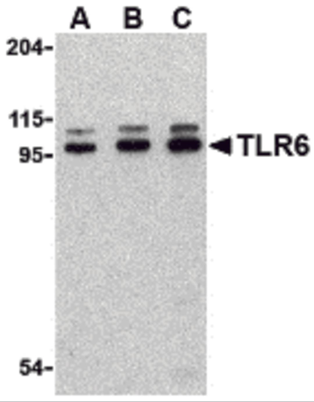 Western blot analysis of TLR6 in Jurkat cell lysate with TLR6 antibody at (A) 0.5, (B) 1 and (C) 2 μg/mL.