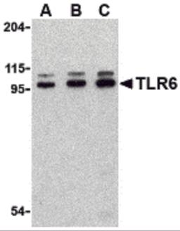 Western blot analysis of TLR6 in Jurkat cell lysate with TLR6 antibody at (A) 0.5, (B) 1 and (C) 2 μg/mL.