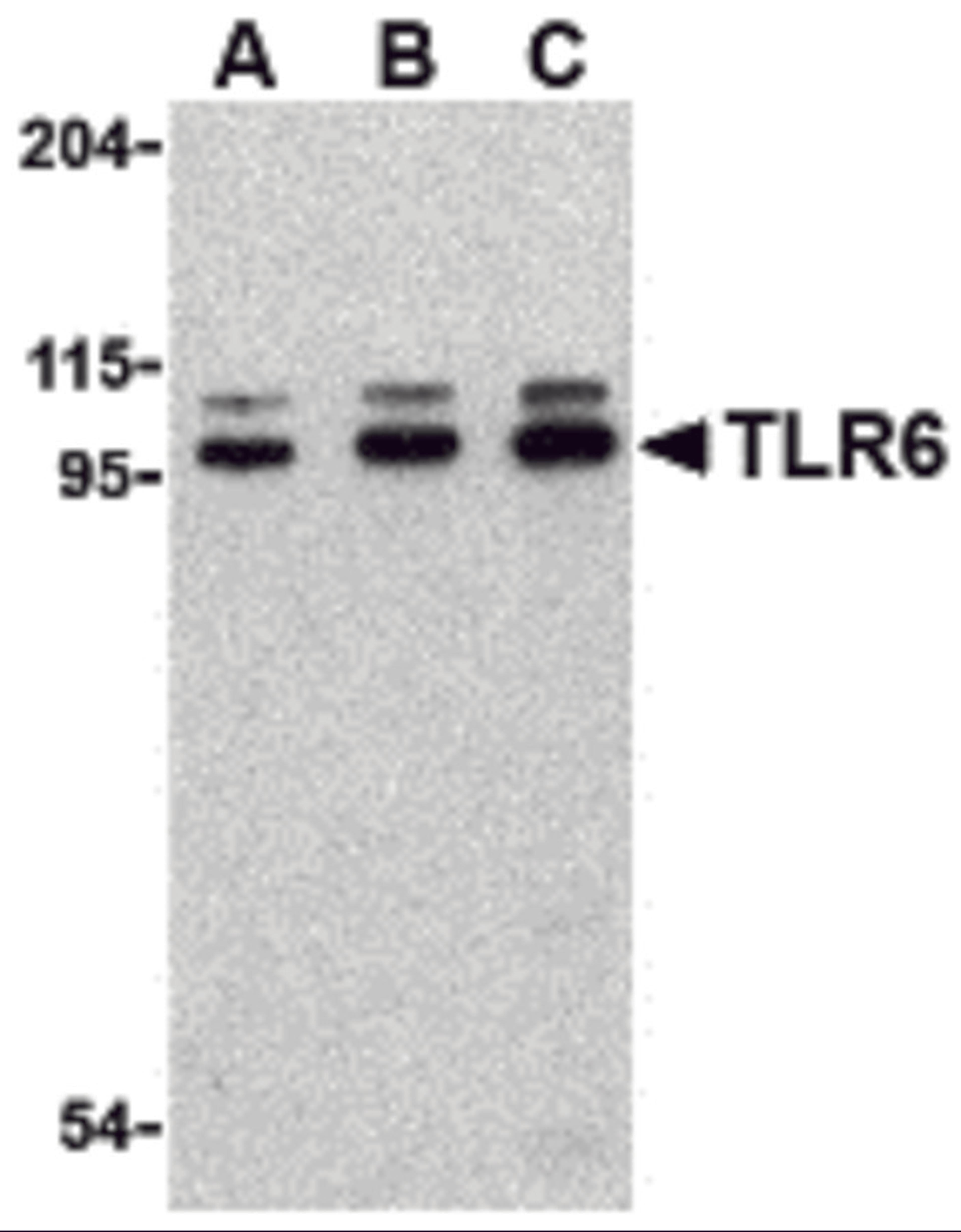 Western blot analysis of TLR6 in Jurkat cell lysate with TLR6 antibody at (A) 0.5, (B) 1 and (C) 2 μg/mL.