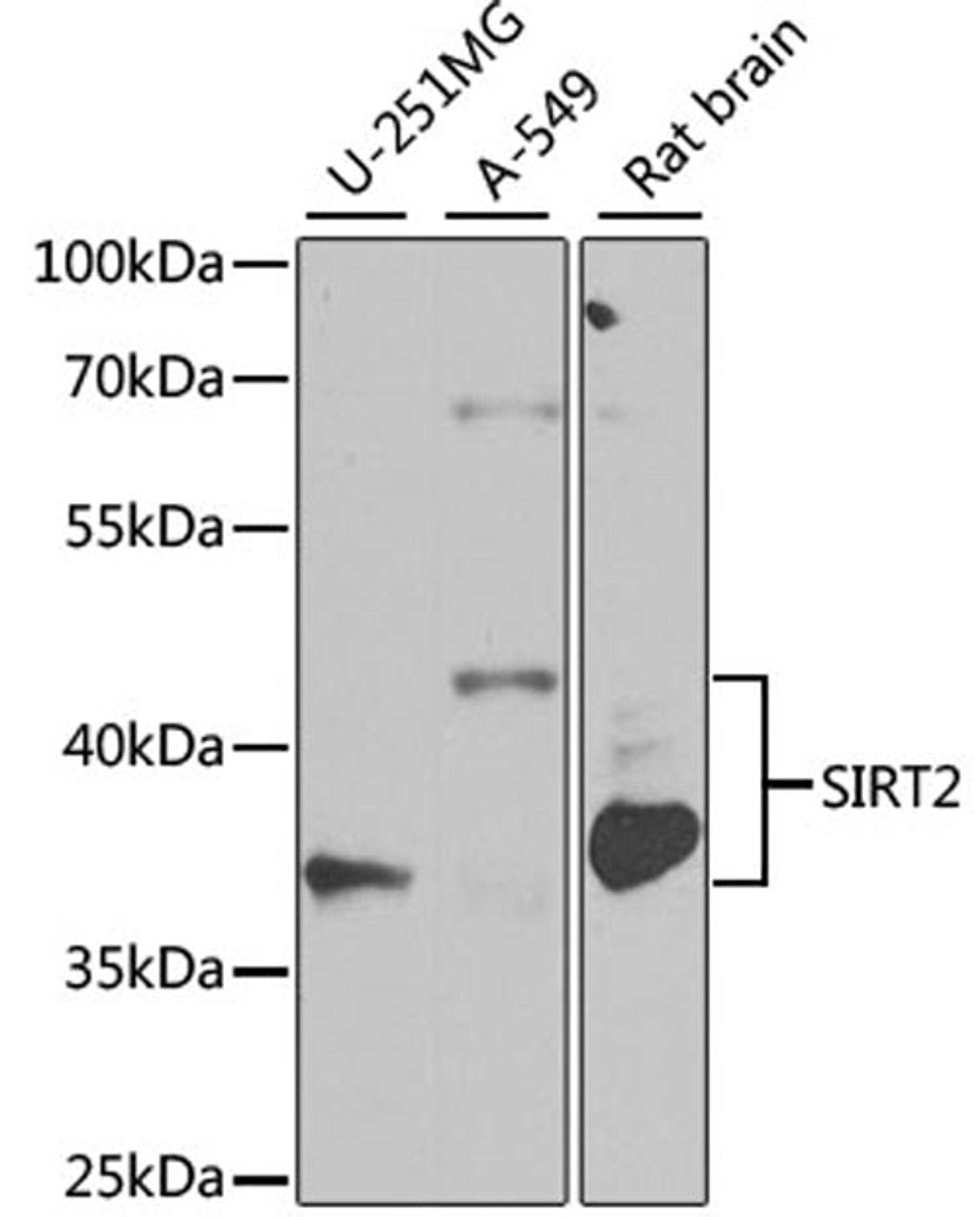 Western blot - SIRT2 antibody (A0273)