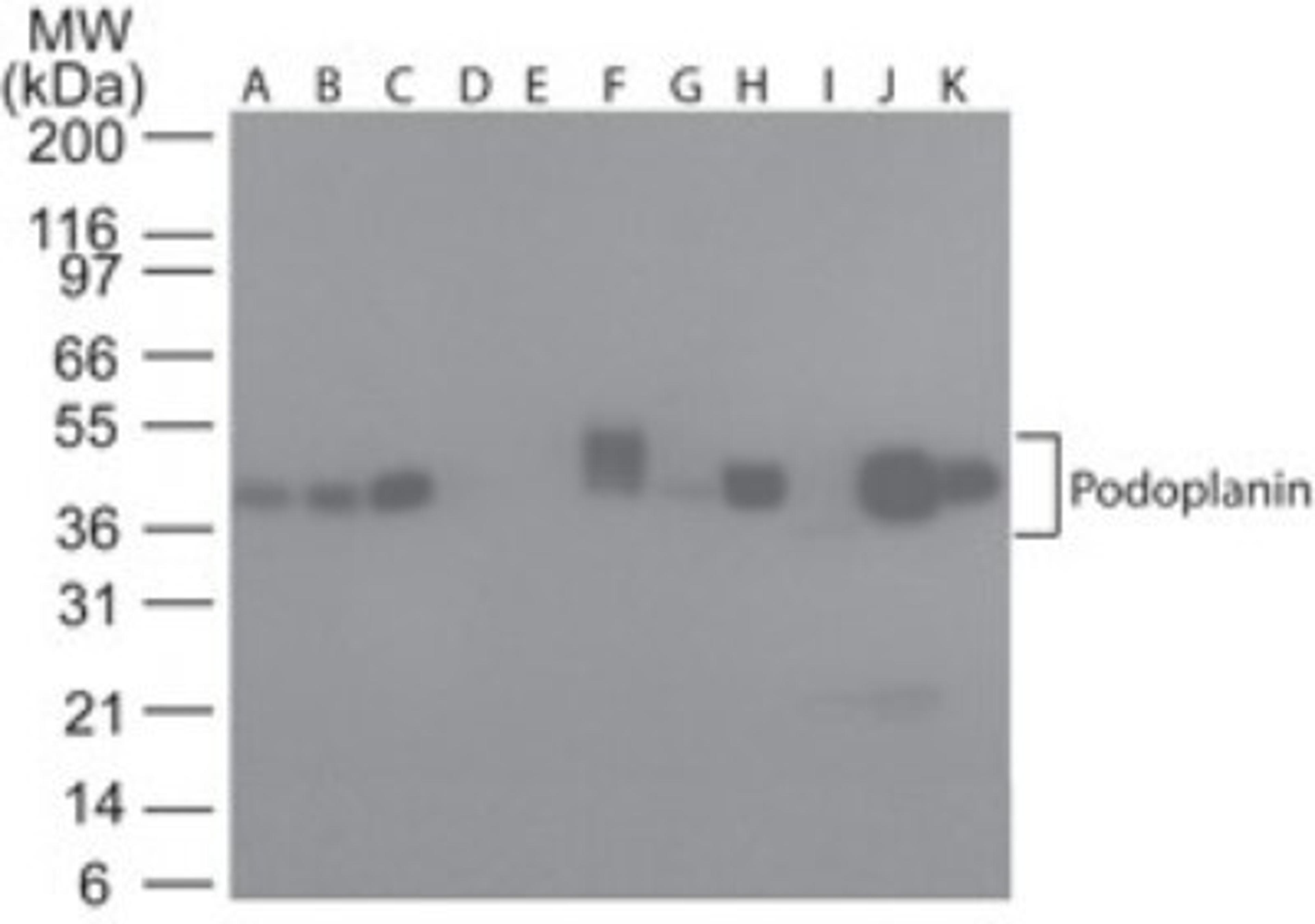 Western Blot: Podoplanin Antibody (NZ-1.2) [NBP2-03952] - Analysis using the Azide Free version of NBP2-03952. Detection of lysate from human A) Brain, B) Heart, C) Small Intestine, D) Kidney, E) Liver, F) Lung, G) Muscle, H) Stomach, I) Spleen, J) Ovary, and K) Testis probed with podoplanin antibody at 5 ug/ml.