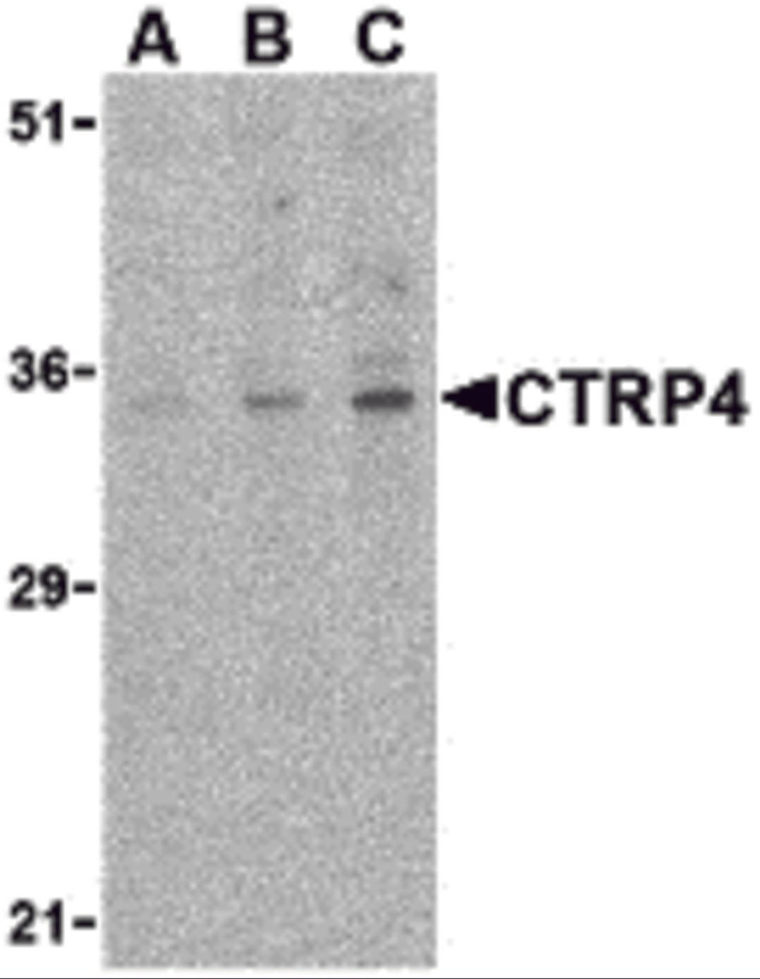 Western blot analysis of CTRP4 in rat brain cell lysate with CTRP4 antibody at (A) 1, (B) 2, and (C) 4 &#956;g/mL. 