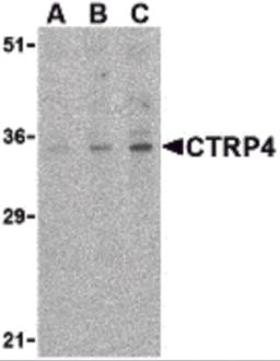 Western blot analysis of CTRP4 in rat brain cell lysate with CTRP4 antibody at (A) 1, (B) 2, and (C) 4 &#956;g/mL. 