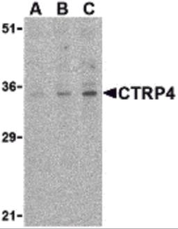 Western blot analysis of CTRP4 in rat brain cell lysate with CTRP4 antibody at (A) 1, (B) 2, and (C) 4 μg/mL.