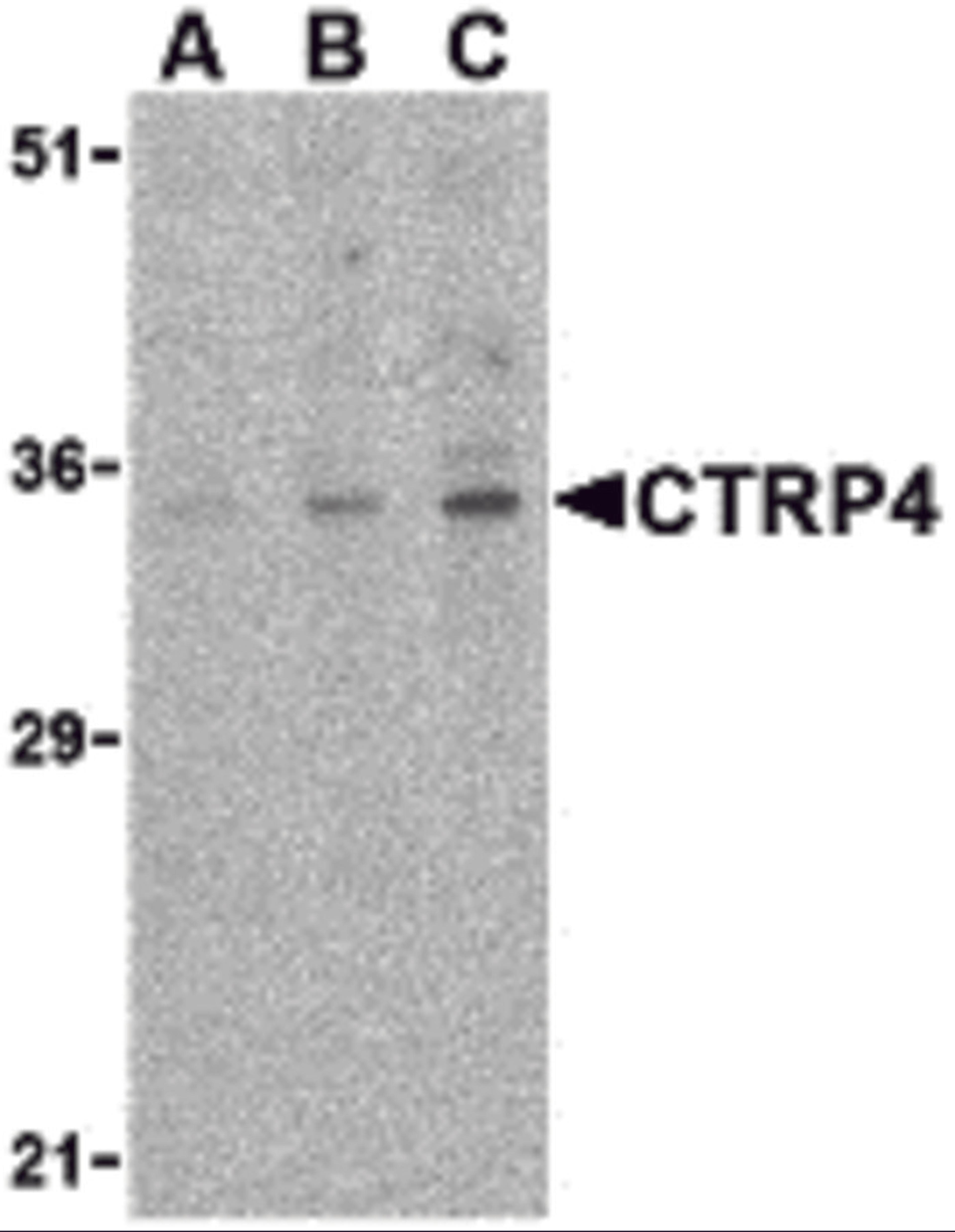 Western blot analysis of CTRP4 in rat brain cell lysate with CTRP4 antibody at (A) 1, (B) 2, and (C) 4 μg/mL.