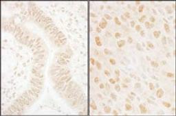 Detection of human and mouse SSB1 by immunohistochemistry.