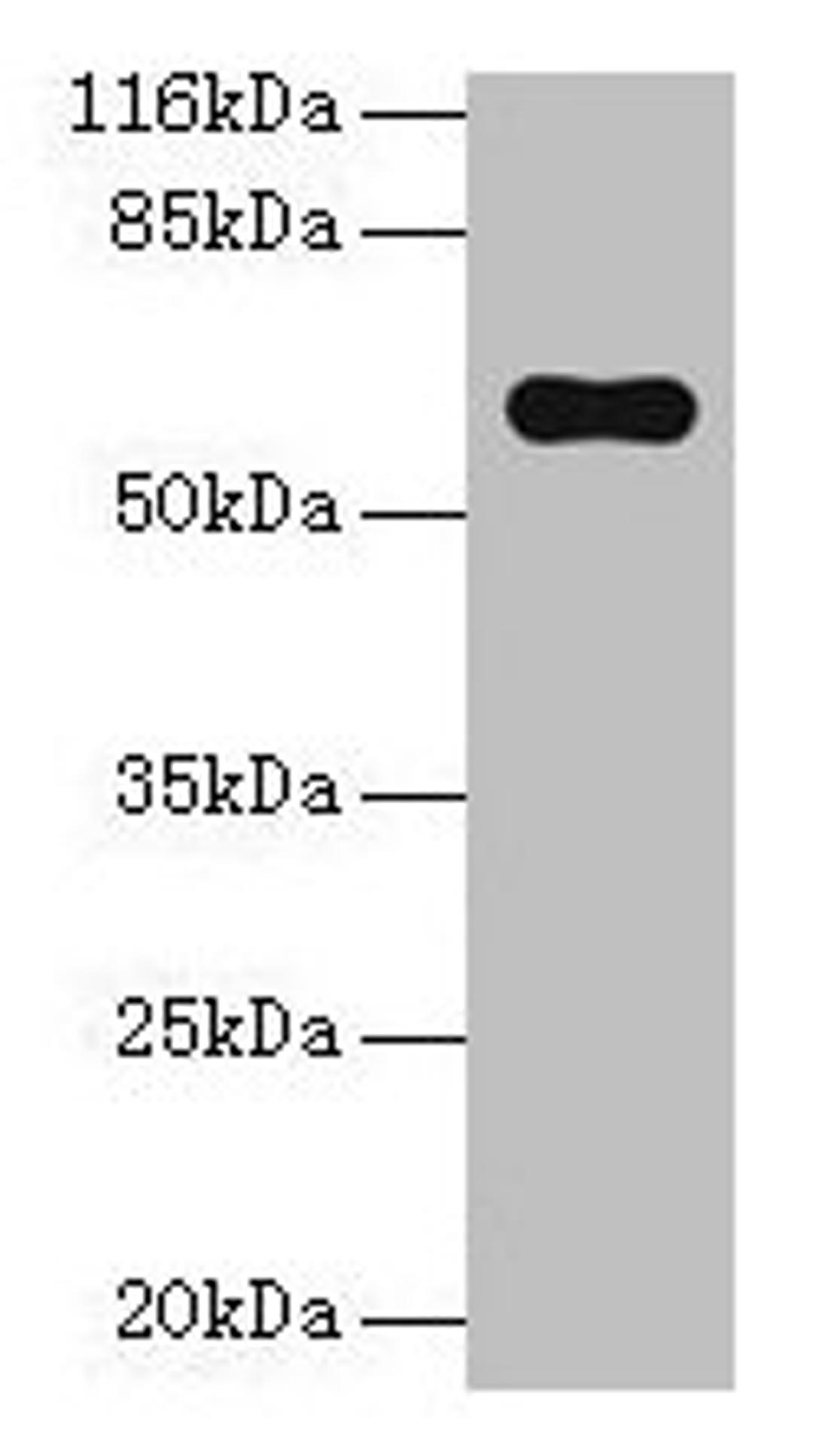 Western blot. All lanes: Pklr antibody at 2µg/ml + Hela whole cell lysate. Secondary. Goat polyclonal to rabbit IgG at 1/10000 dilution. Predicted band size: 63, 59 kDa. Observed band size: 63 kDa