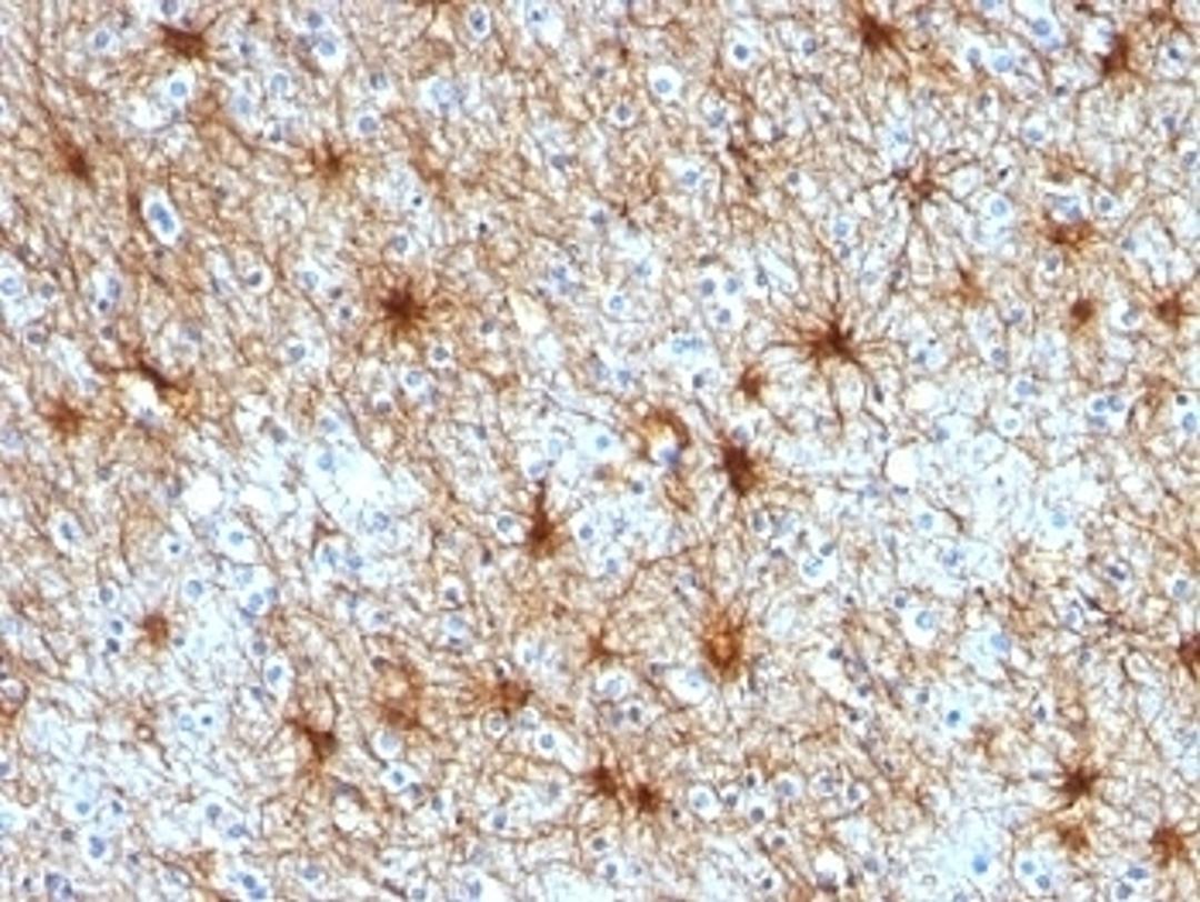 Formalin-fixed, paraffin-embedded human cerebellum stained with GFAP antibody (ASTRO/789).