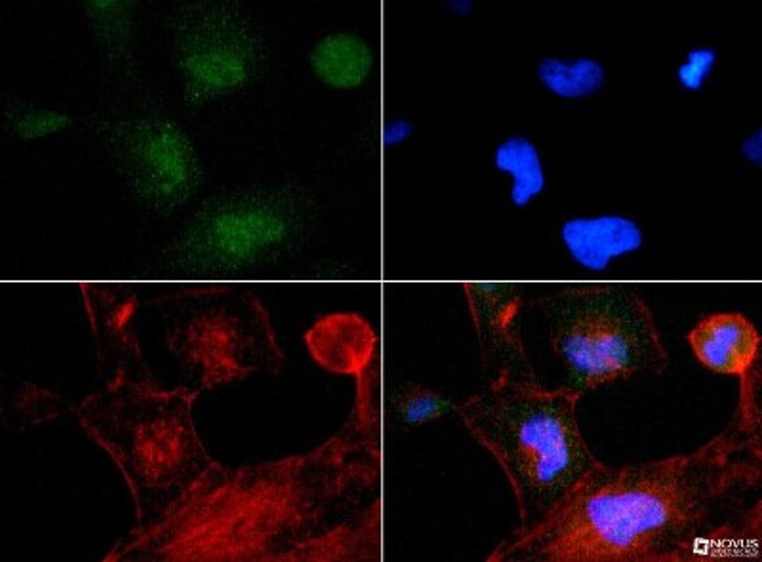 Immunocytochemistry/Immunofluorescence: TP53INP2 Antibody [NBP1-71704] - TP53INP2 antibody was tested at 1:200 in HeLa cells with FITC (green). Nuclei and actin were counterstained with Dapi (blue) and Phalloidin (red).