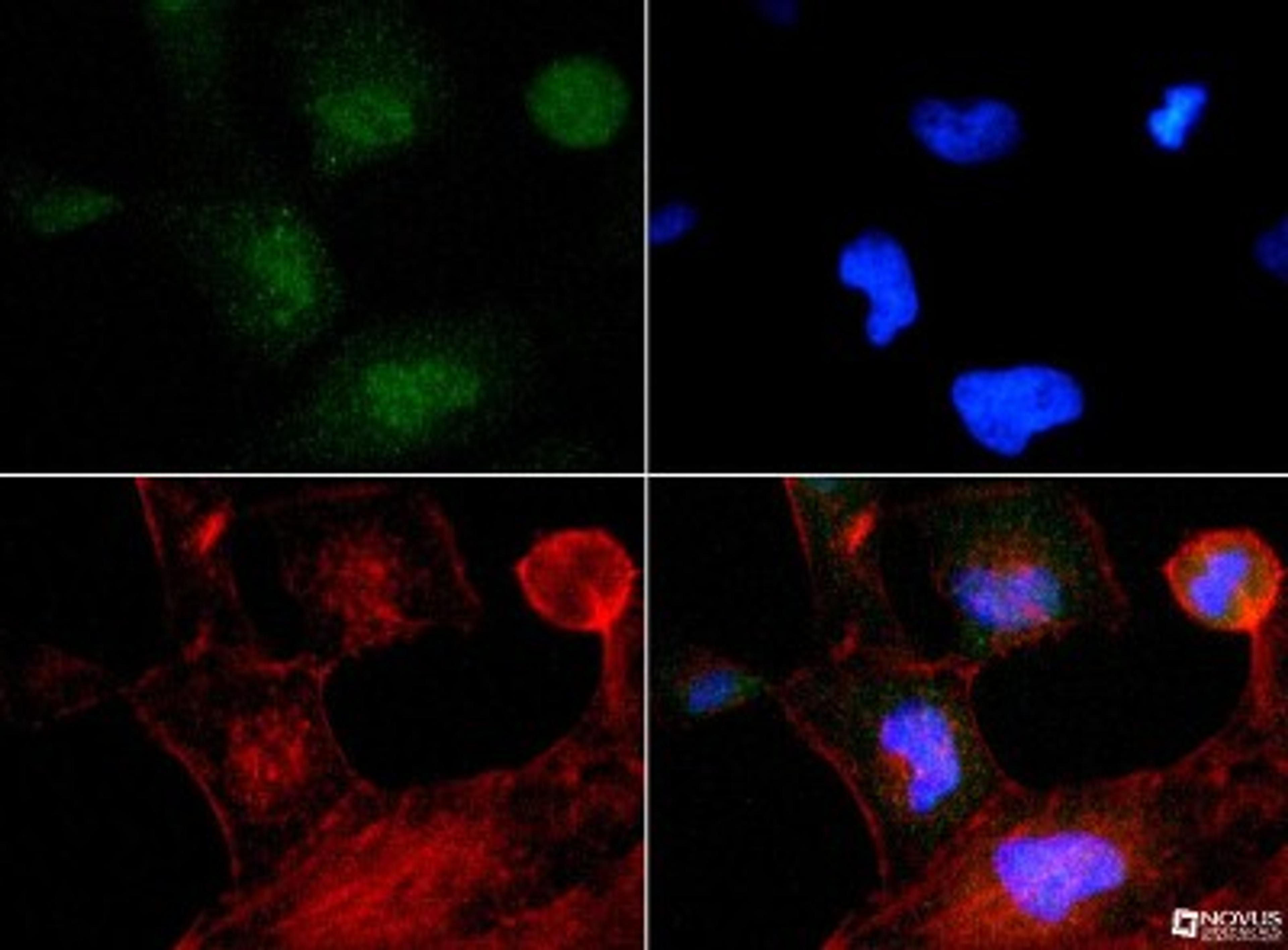 Immunocytochemistry/Immunofluorescence: TP53INP2 Antibody [NBP1-71704] - TP53INP2 antibody was tested at 1:200 in HeLa cells with FITC (green). Nuclei and actin were counterstained with Dapi (blue) and Phalloidin (red).