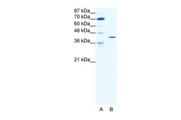 Antibody used in WB on Human HepG2 at 1.25 ug/ml.