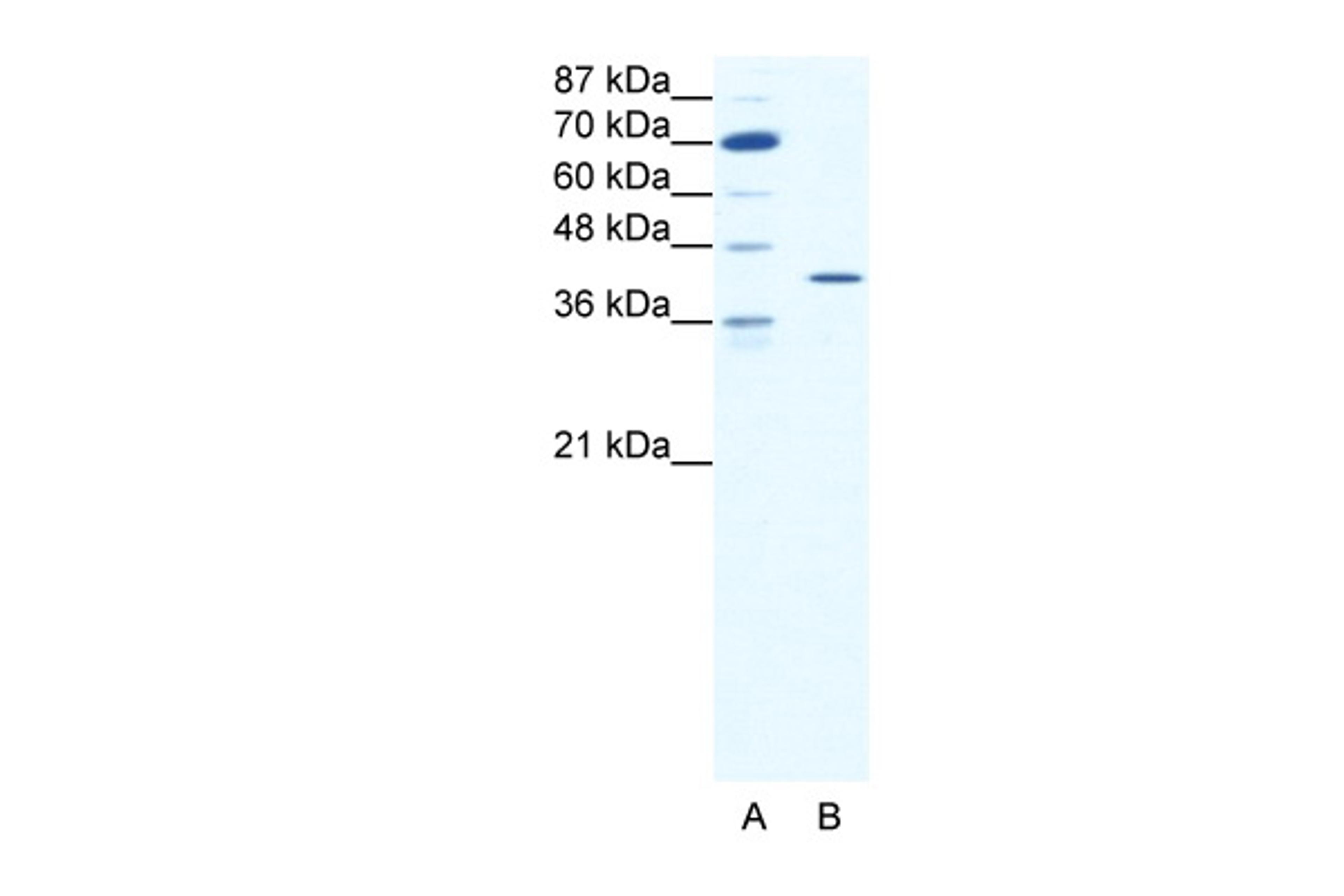 Antibody used in WB on Human HepG2 at 1.25 ug/ml.