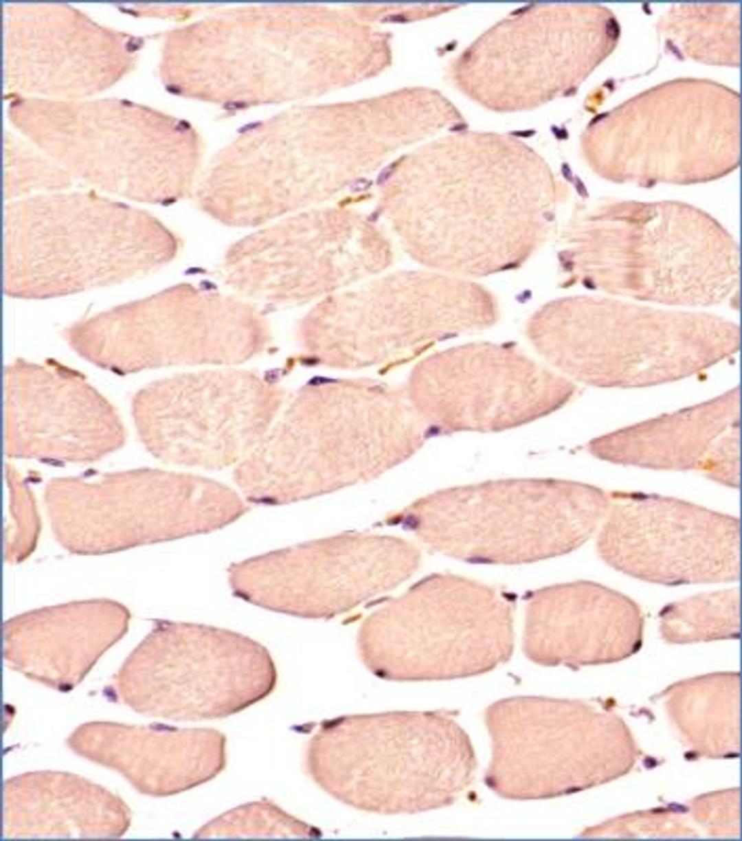 Immunohistochemistry-Paraffin: Glut4 Antibody (6H11NB) [NBP2-44298] - IHC analysis of a formalin fixed and paraffin embedded tissue section of normal human skeletal muscle using 1:300 dilution of Glut4 antibody (clone 6H11NB). The antibody generated a diffused staining in the blood vessels as well as the cytoplasm/sarcoplasma of skeletal muscles while the nuclei did not show any positivity for Glut4.