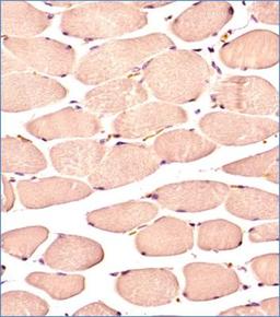 Immunohistochemistry-Paraffin: Glut4 Antibody (6H11NB) [NBP2-44298] - IHC analysis of a formalin fixed and paraffin embedded tissue section of normal human skeletal muscle using 1:300 dilution of Glut4 antibody (clone 6H11NB). The antibody generated a diffused staining in the blood vessels as well as the cytoplasm/sarcoplasma of skeletal muscles while the nuclei did not show any positivity for Glut4.