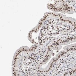 Immunohistochemistry-Paraffin: AUTS2 Antibody [NBP1-84717] - Staining of human gall bladder shows distinct nuclear positivity in glandular cells.