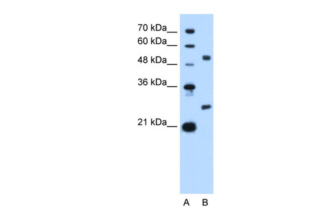 Antibody used in WB on Human HepG2 cells at 2.5 ug/ml.