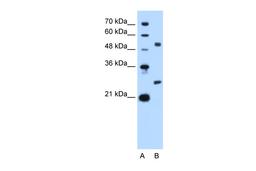 Antibody used in WB on Human HepG2 cells at 2.5 ug/ml.