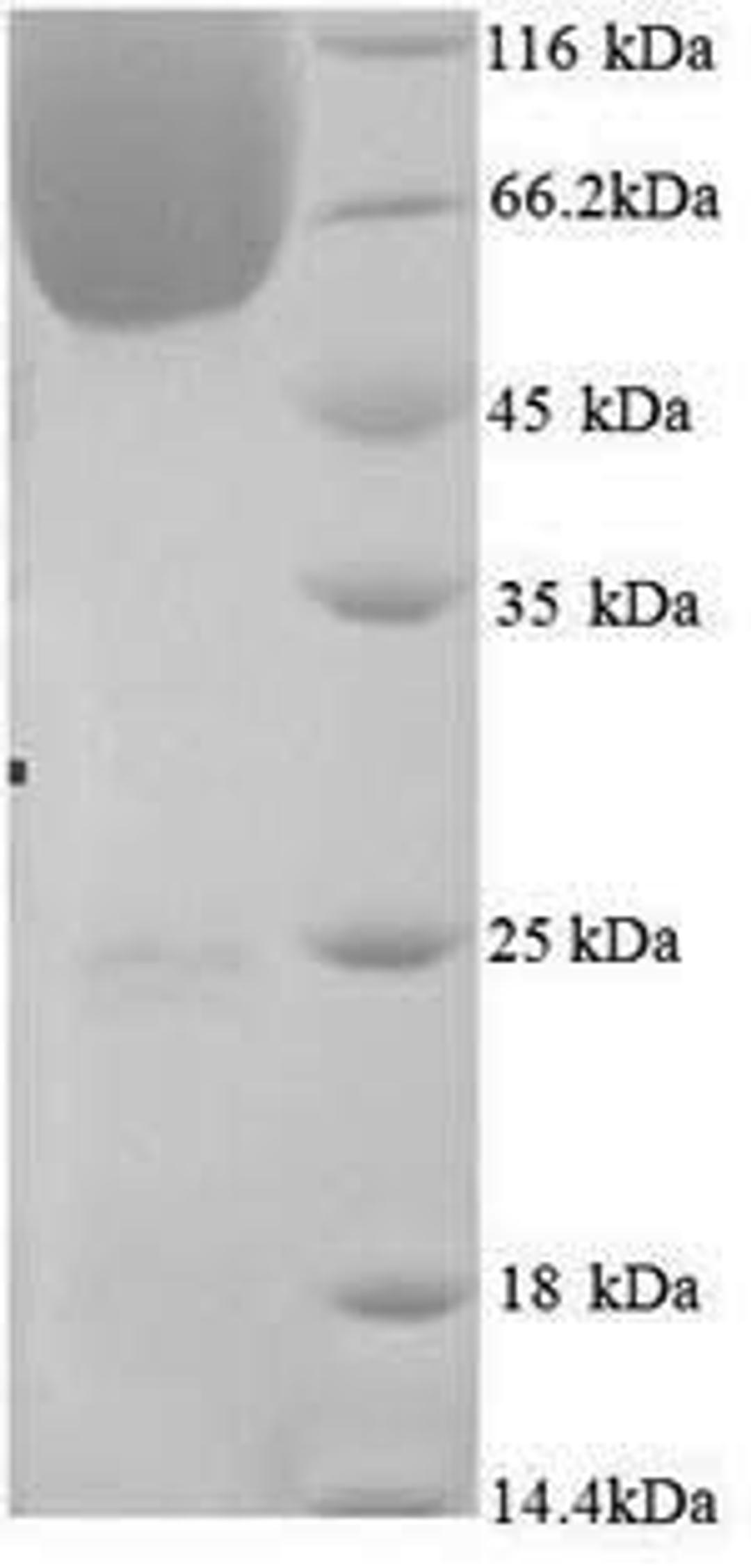 (Tris-Glycine gel) Discontinuous SDS-PAGE (reduced) with 5% enrichment gel and 15% separation gel.